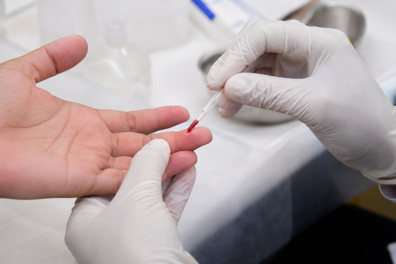 Julho Amarelo intensifica prevenção às hepatites em Jundiaí